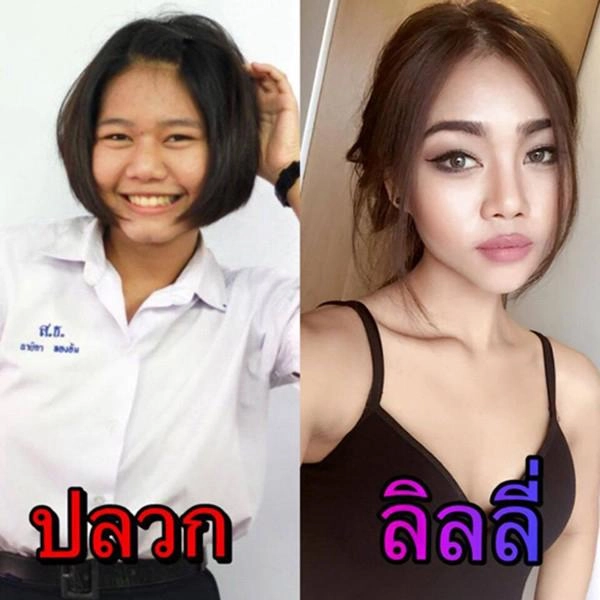 Nổi tiếng với sắc vóc đẹp như mơ hotgirl thái lan gây sốc khi công khai dao kéo toàn thân - 4