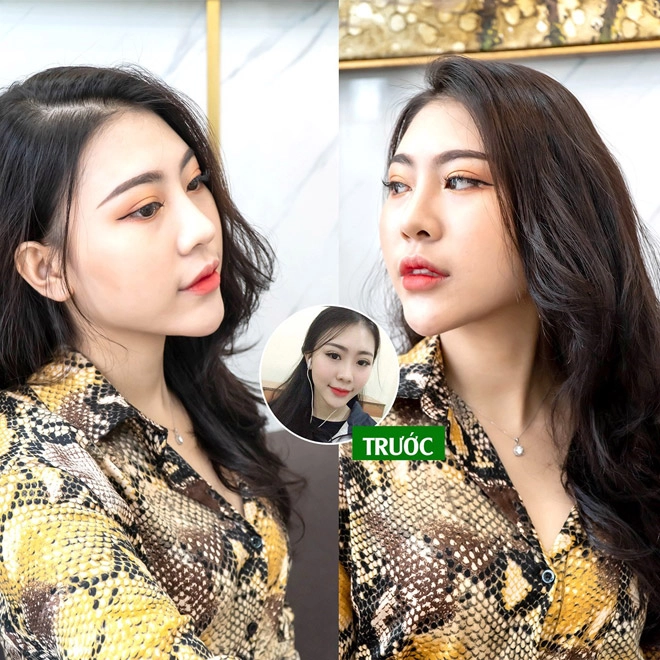 Phẫu thuật thẩm mỹ toàn diện khuôn mặt có thể thực hiện thành công bởi chính bác sĩ việt - 4