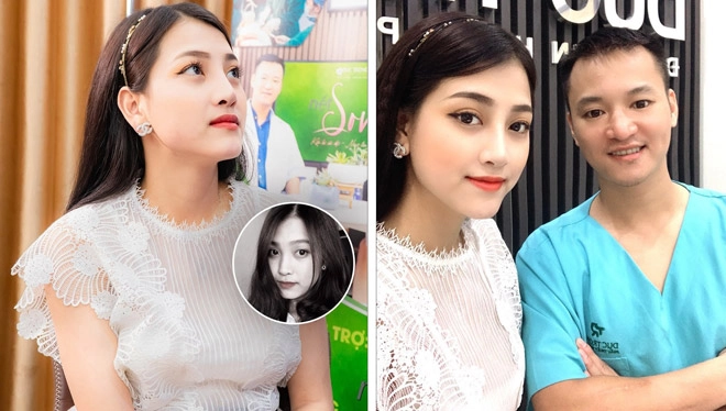 Phẫu thuật thẩm mỹ toàn diện khuôn mặt có thể thực hiện thành công bởi chính bác sĩ việt - 5