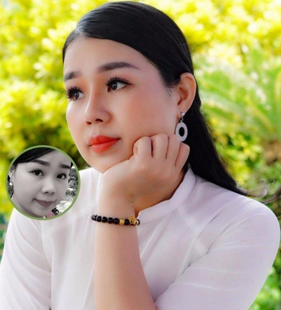 Phẫu thuật thẩm mỹ toàn diện khuôn mặt có thể thực hiện thành công bởi chính bác sĩ việt - 6