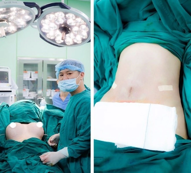 Phẫu thuật thẩm mỹ toàn diện khuôn mặt có thể thực hiện thành công bởi chính bác sĩ việt - 7