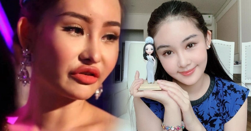 Quên đi thời môi sưng căng phồng ngân anh giờ đây thăng hạng nhan sắc không ngờ - 1