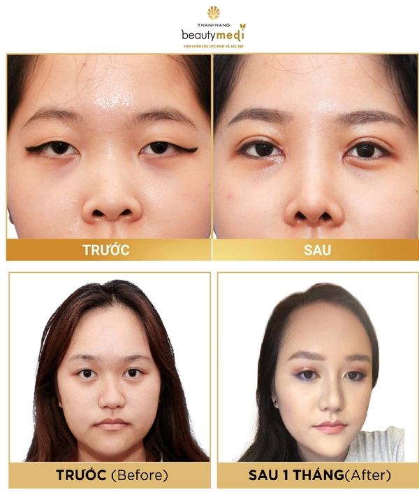 Ra mắt mẹ bạn trai bị chê thẳng thừng vì mũi xấu cô gái quyết tâm làm điều này - 5