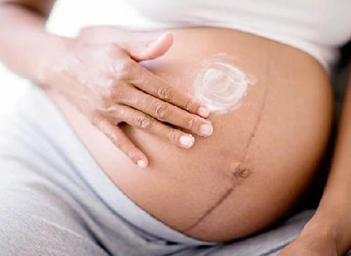 Rạn da đến mấy cũng mờ đi với công thức thần kỳ từ viên vitamin e và nha đam - 6