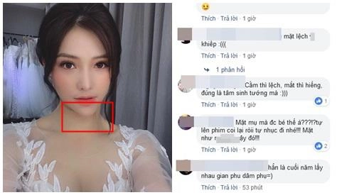 Sau ồn ào văng tục tại tòa lưu đê ly tiếp tục lộ cằm nhọn lệch hẳn sang một bên - 3