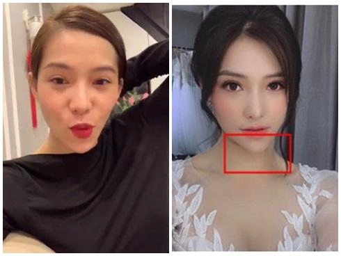Sau ồn ào văng tục tại tòa lưu đê ly tiếp tục lộ cằm nhọn lệch hẳn sang một bên - 4
