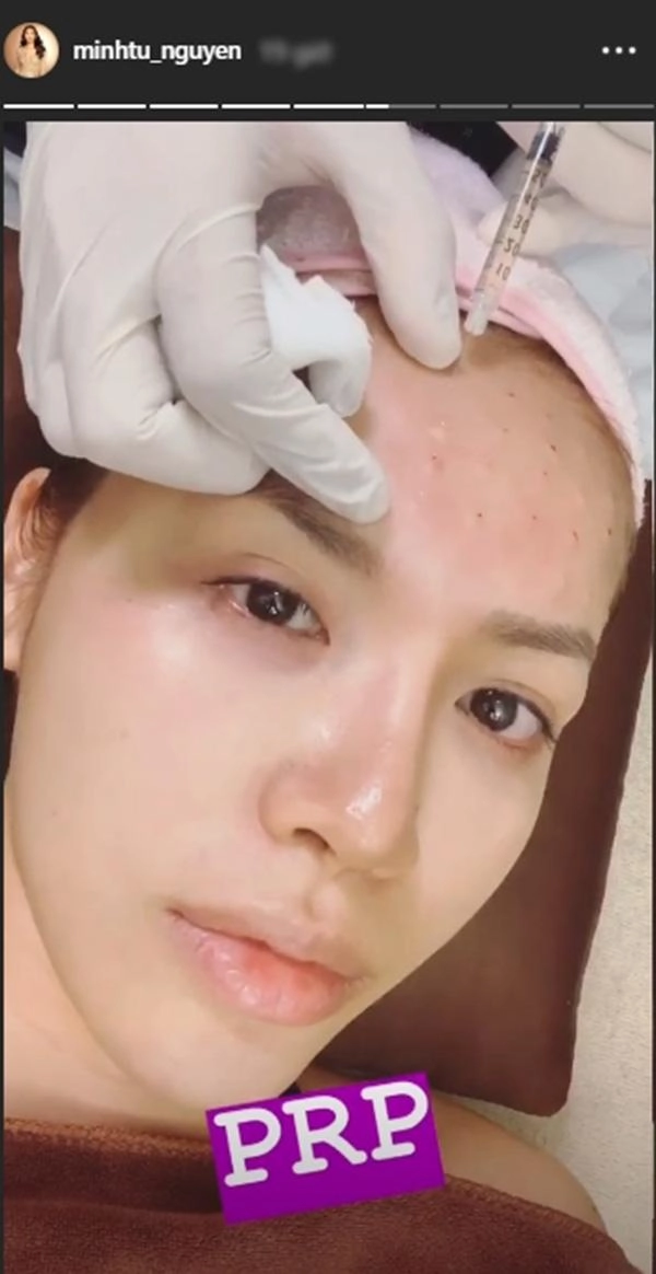 Sững người trước kết quả dương tính với hiv sau thẩm mỹ đã có 1 trường hợp tại việt nam - 3