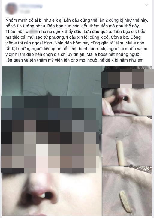 Thế giới bây giờ đảo điên thật rồi tưởng lòi sụn sau nâng mũi tháo ra lại chẳng phải sụn - 2