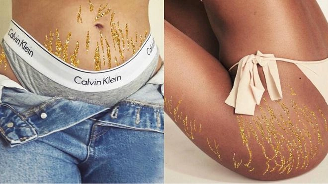 Thi nhau khoe vết rạn da trên instagram trào lưu sốt 100 độ của hội chị em - 5