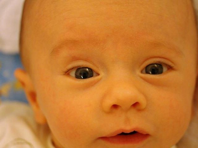 Trẻ sơ sinh bị vàng da vàng mắt như thế nào là nguy hiểm - 1