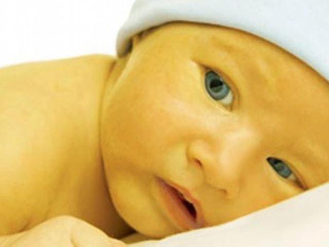 Trẻ sơ sinh bị vàng da vàng mắt như thế nào là nguy hiểm - 2