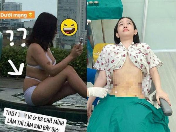 Tự tin khoe hình hở bạo thuý vi bị hỏi móc chuyện tăng cân hút mỡ và thực tế thì - 1