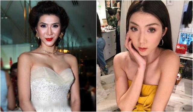 Từng nude 100 sao nữ này cũng đã vướng vào cuộc đua dao kéo nhan sắc đến chóng mặt - 3