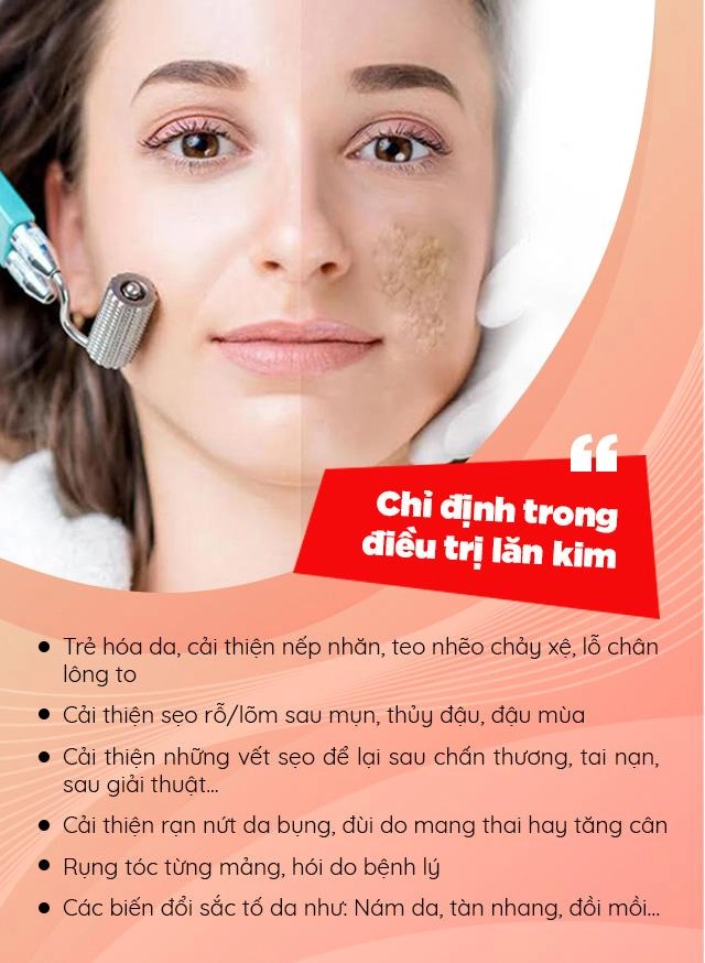 Tưởng da căng mịn sau lăn kim cô gái gây sốc toàn tập với khuôn mặt chi chít mụn mảng - 9