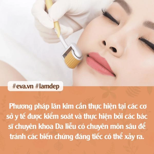 Tưởng da căng mịn sau lăn kim cô gái gây sốc toàn tập với khuôn mặt chi chít mụn mảng - 10
