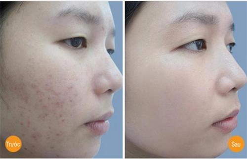 Uống bột nghệ pha với thứ này da đen đến mấy cũng phải bật 2 tone - 6