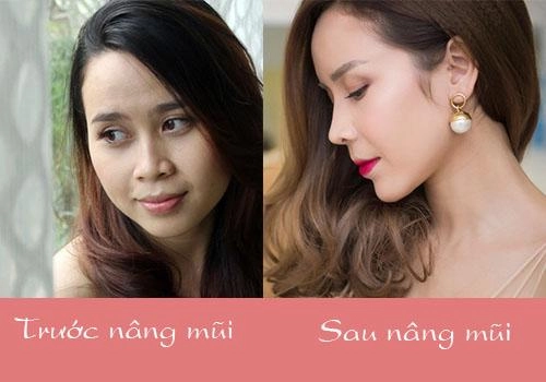 Xuất hiện với diện mạo khác lạ phải chăng lưu hương giang chạy theo trào lưu độn trán - 1