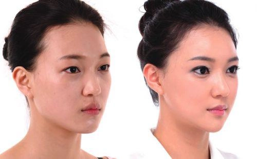 Xuất hiện với diện mạo khác lạ phải chăng lưu hương giang chạy theo trào lưu độn trán - 7