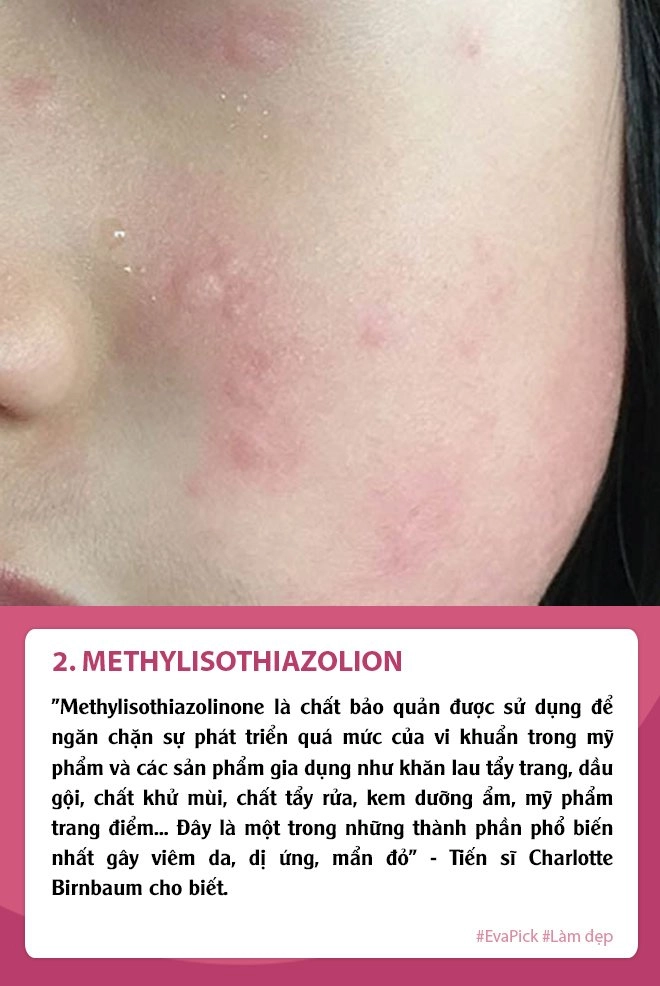 5 thành phần thường gặp trong mỹ phẩm ngày ngày tàn phá làn da thúc đẩy lão hóa sớm - 2