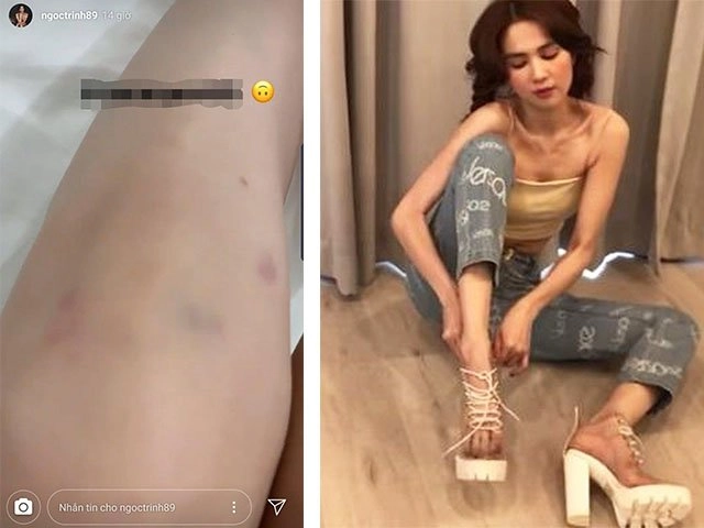 Đằng sau vẻ ngoài hoàn hảo ngọc trinh phải dặm phấn từ đầu đến chân để che khuyết điểm - 5