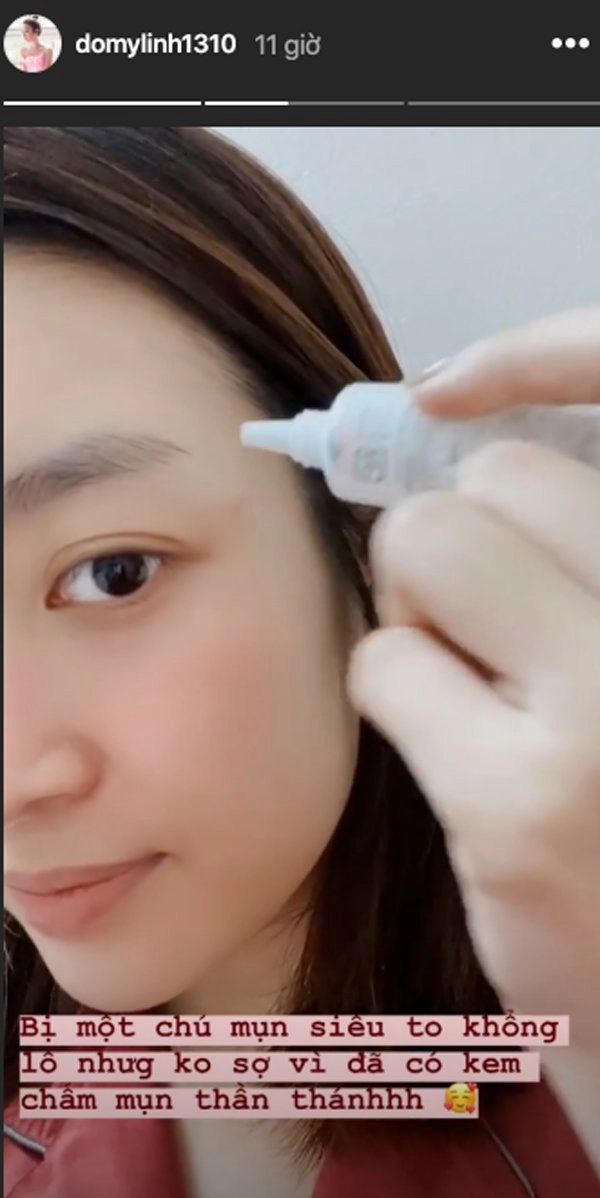Hoa hậu thời dịch phạm hương hhen niê tự làm nước detox đỗ mỹ linh diệt mụn tận gốc - 9