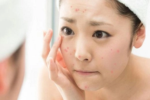 Ở nhà cũng cần thoa kem chống nắng còn điều gì nàng chưa biết hãy cùng kiểm tra xem - 22