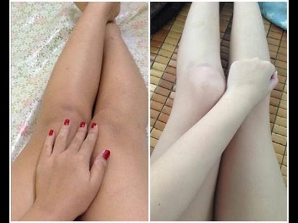 Quên ngay kem trộn đi hãy lưu lại cách làm trắng da toàn thân không bắt nắng này - 6