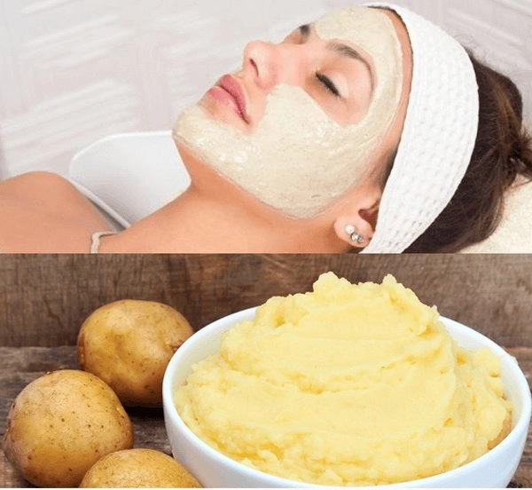 Da mặt láng o da không sẹo không tàn nhang với công thức từ mặt nạ khoai tây - 6