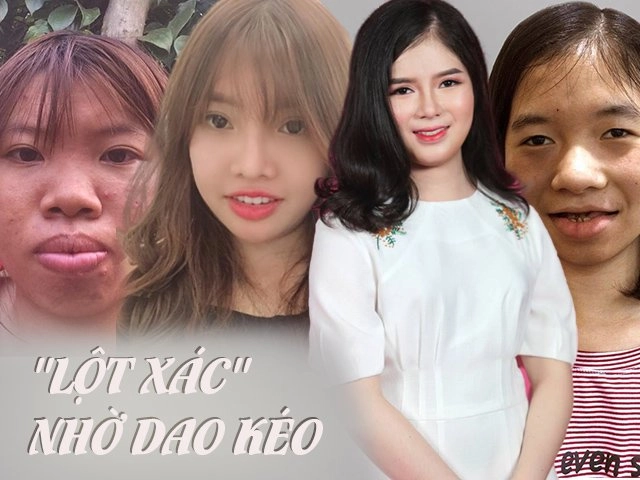 Sau nhiều năm dao kéo phượng thị nở đăng đàn chuyện bị chế giễu bởi quá khứ kém xinh - 12