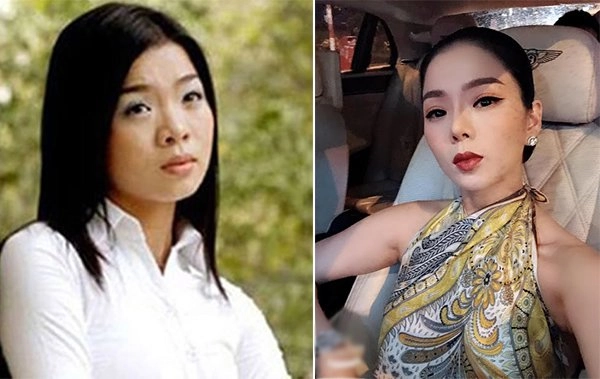 Người nổi tiếng từng gặp biến chứng sau dao kéo có người phải sống mãi với gương mặt đáng sợ - 5