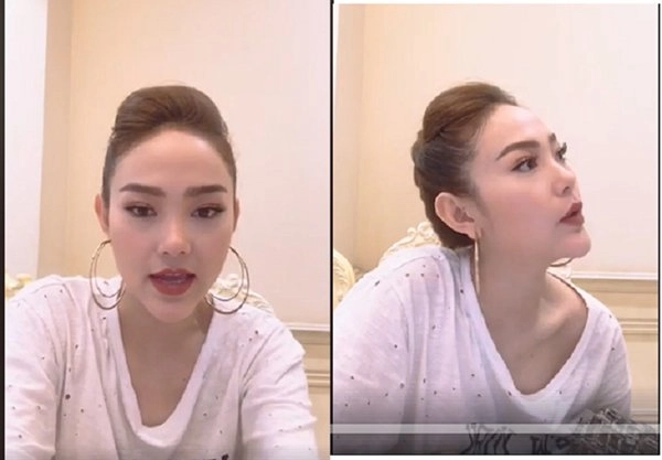 Người nổi tiếng từng gặp biến chứng sau dao kéo có người phải sống mãi với gương mặt đáng sợ - 10