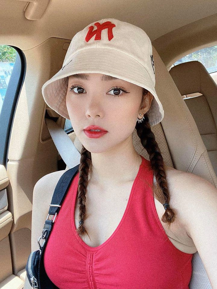 Người nổi tiếng từng gặp biến chứng sau dao kéo có người phải sống mãi với gương mặt đáng sợ - 12