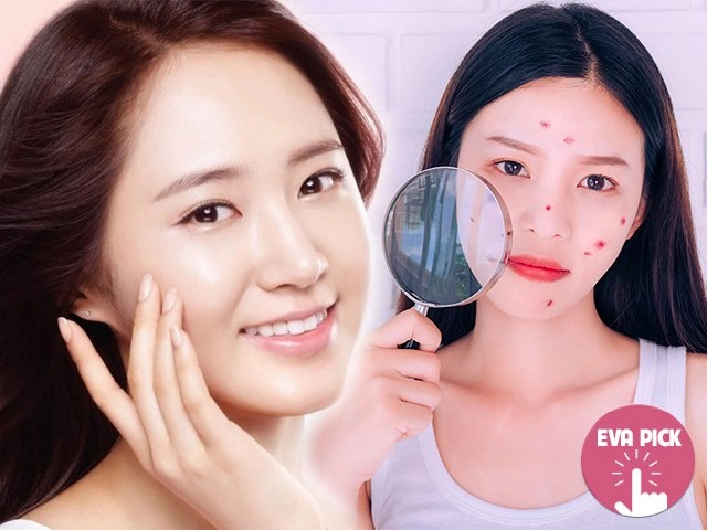 Nổi tiếng là thiên đường mỹ phẩm loạt sao hàn vẫn chuộng những nguyên liệu rẻ tiền để trị mụn - 17