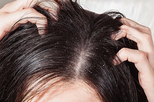 Ở nhà mà mụn cũng nổi chi chít đó là bởi những thói quen tai hại mà bạn vẫn làm - 4