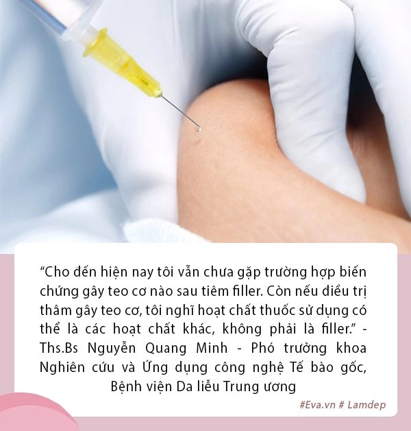 Từ vụ teo cơ do tiêm filler trị thâm nàng lưu ngay những lời khuyên này từ bác sĩ - 2