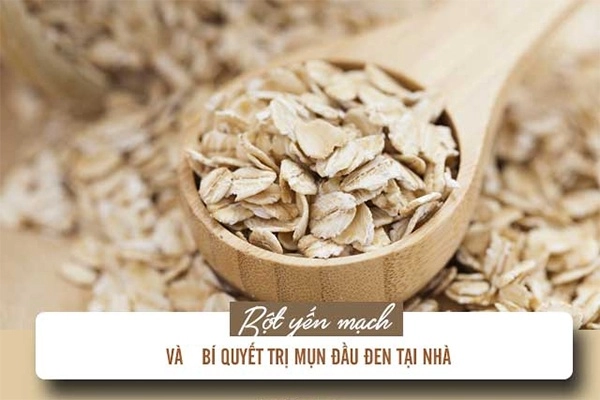 10 cách trị mụn đầu đen ở mũi má trán an toàn hiệu quả nhanh nhất - 13