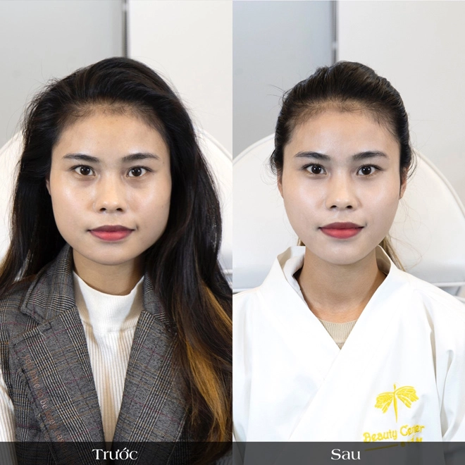 2020 rồi tạm biệt gương mặt to bè uline đi vì đã có vline perfect - 2