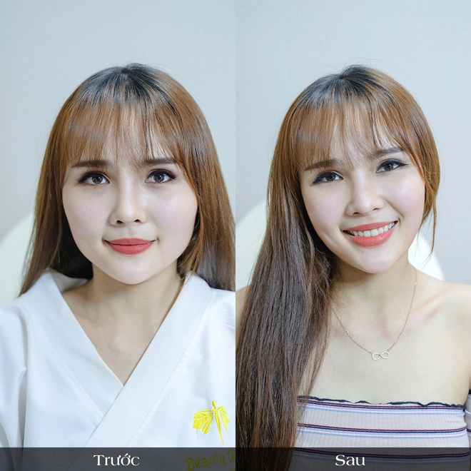 2020 rồi tạm biệt gương mặt to bè uline đi vì đã có vline perfect - 3
