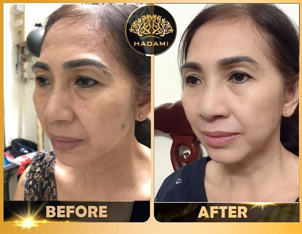 4 lý do nên chọn kem chống lão hoá hadami - 6
