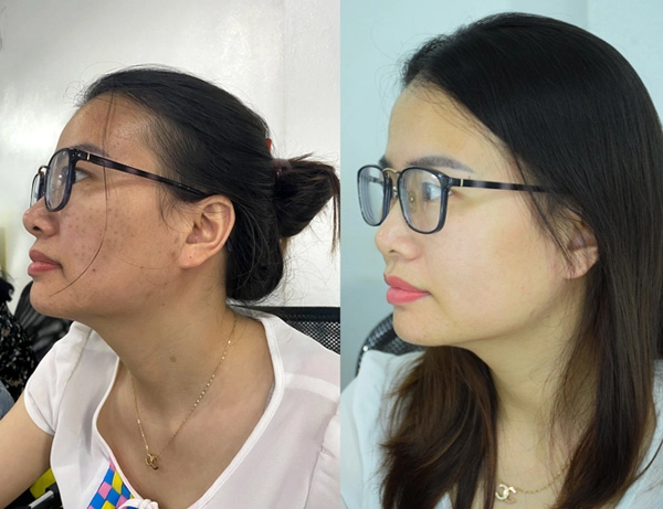4 lý do nên chọn kem chống lão hoá hadami - 7