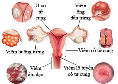 Bác sĩ soái ca chia sẻ kinh nghiệm tân trang vùng kín - 3