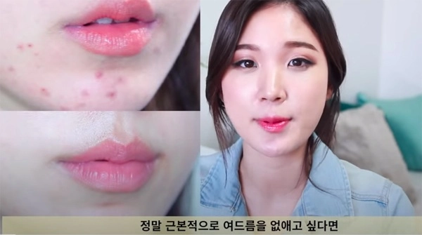 Beauty blogger hàn chia sẻ nên và không nên ăn gì cho da mụn nàng lưu ngay vào thực hiện - 1