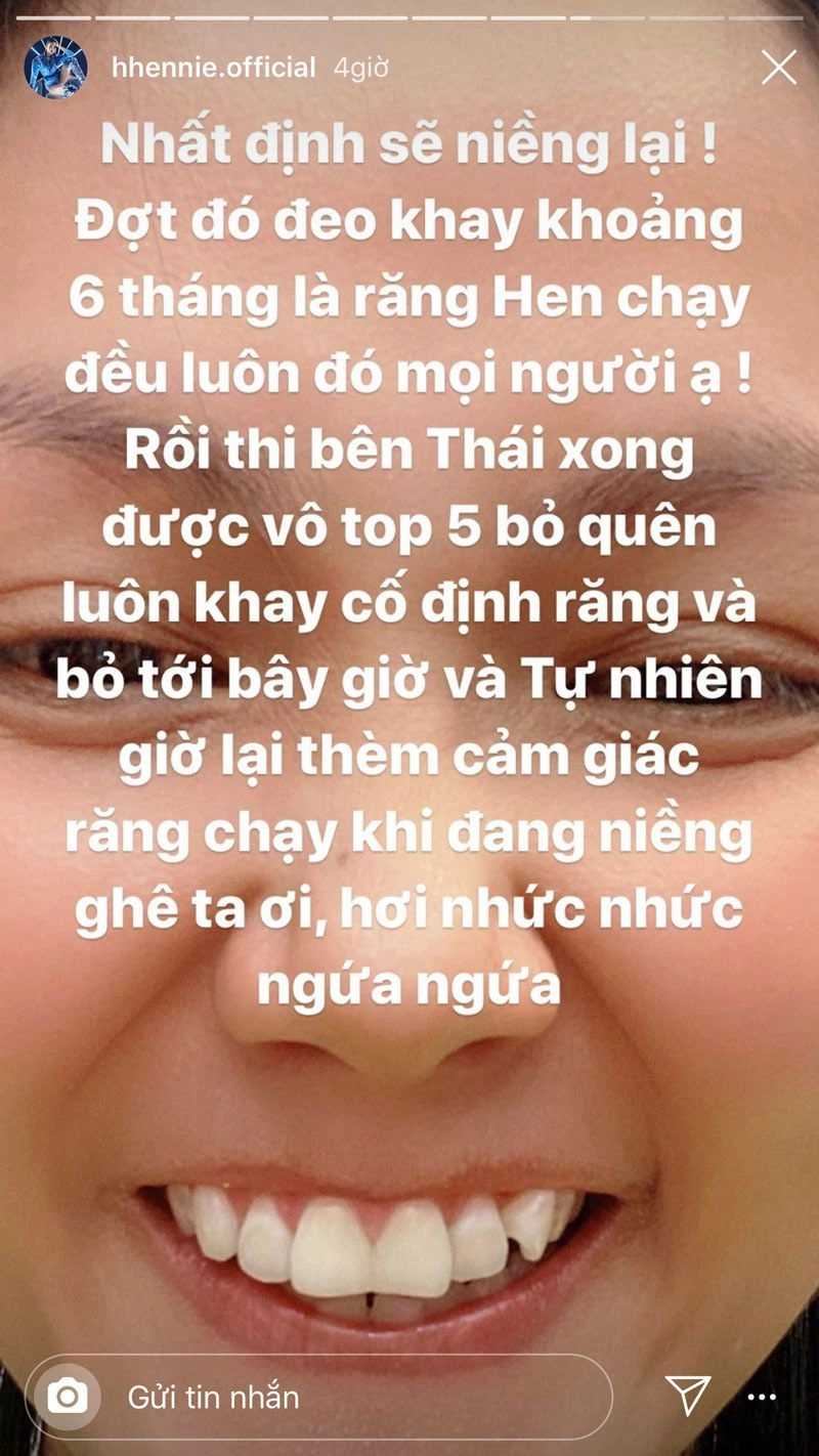 Bị nói làm răng sứ hhen niê có cách đáp trả nhẹ nhàng nhưng đầy thuyết phục - 4