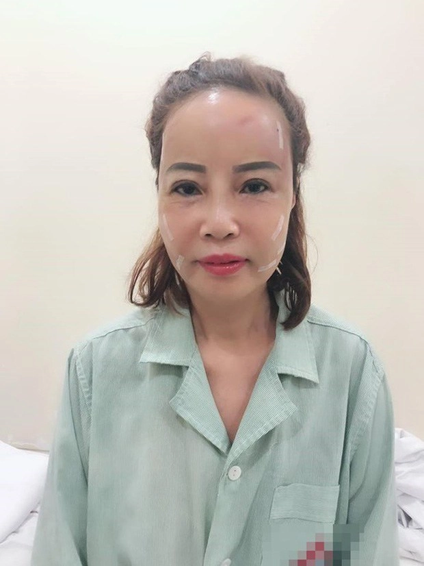 Bộ đôi cô dâu 62 và65 tuổi đọ sắc thu saonhỉnh hơn đàn chị nhờtrùng tu tiền tỷ - 9