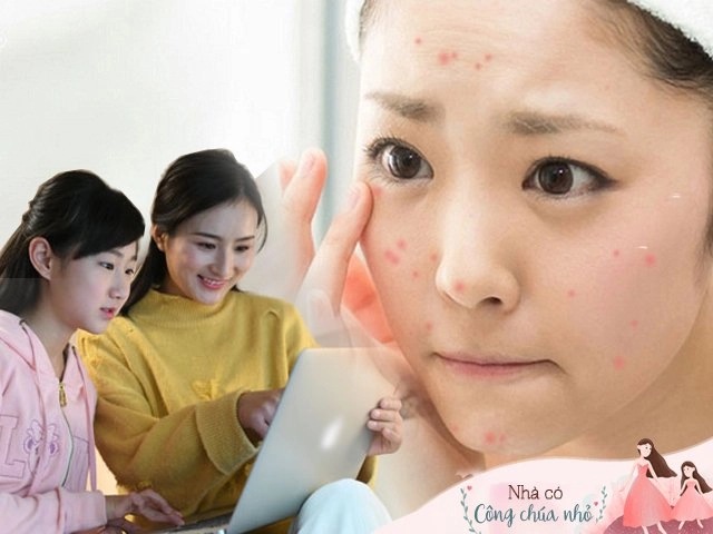 Đầu tư tiền triệu đi trị mụn mà chẳng thấy hiệu quả hãy lắng nghe giải đáp của chuyên gia - 6