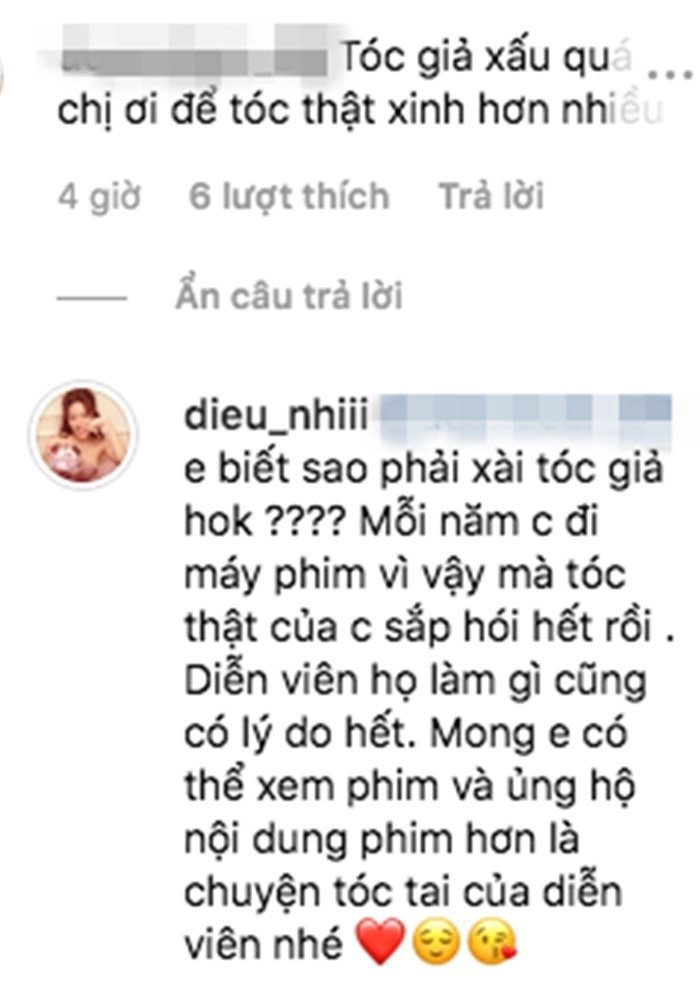 Giã từ tóc giả diệu nhi tìm ra bí quyết che trán hói lại trông trẻ ra vài tuổi - 14