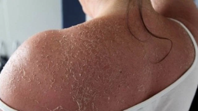 Loạt mỹ phẩm nghe công dụng đã không dám mua mà nhiều chị em vẫn tin sái cổ - 3