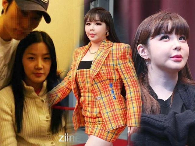 Mỹ nhân hàn quốc lột xác không dao kéo tút mặt vlive chỉnh chân vòng kiềng tự nhiên - 13