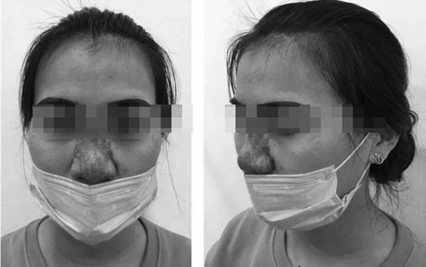 Sau 10 năm ca hát đến bây giờ bích phương mới tự tin thừa nhận mũi giả cằm giả - 16