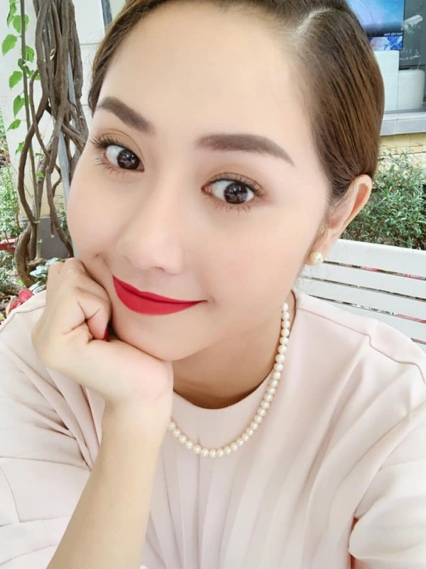 Sau 3 lần sửa mũi hư tường vi giờ đây xinh đẹp như thiên thần - 5